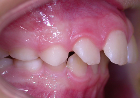 ortodontia2